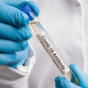 Kroger Announces COVID-19 Antibody Rapid Testing Program